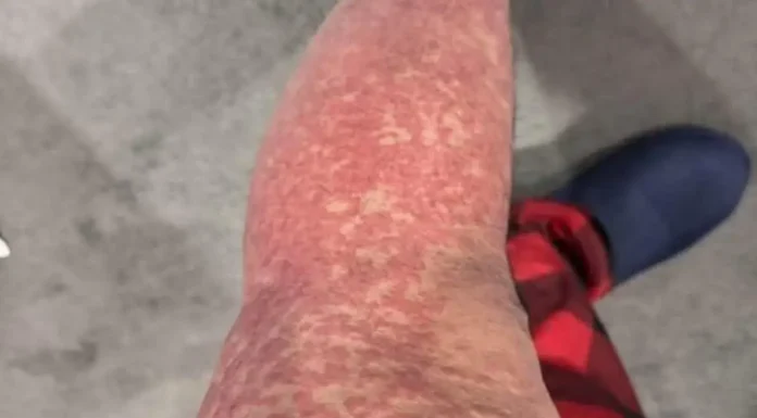 What Your Skin Could Be Telling You About Hidden Health Issues