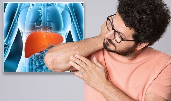 Fatty liver disease: 6 symptoms you need to know
