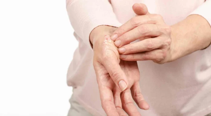 The Meaning Of The Intriguing Gesture Of Scratching The Palm Of Another Person’s Hand