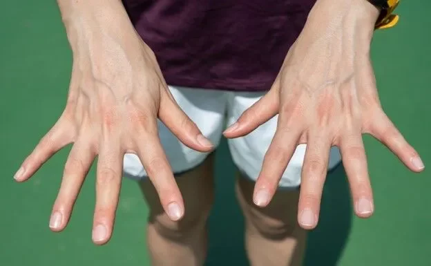 Visible Veins Explained: Normal Causes, Health Risks, and When to Worry