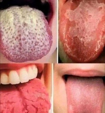 f you have these four symptoms on your tongue, they may indicate underlying health conditions.