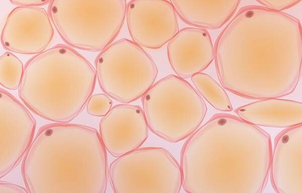 How to Eliminate Toxins From Fat Cells That Are Making You Fatigued and Swollen