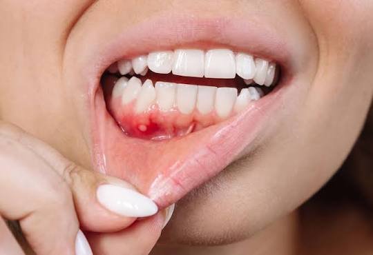 Hidden Dangers in Your Mouth: Early Signs of Oral Cancer