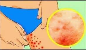 THESE ARE THE SIGNS THAT IT IS CR, SEE MORE!!!?