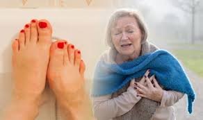 6 Silent Signs in Your Feet That Could Warn of a Heart Attack Weeks in Advance