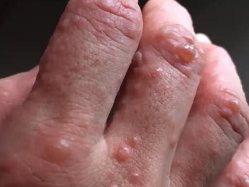 Don’t overlook these small red spots on your arm – They could be important warning signs