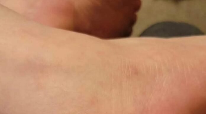 These are the consequences of wearing used…