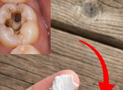 5 Simple Natural Home Remedies to Help Prevent Cavities And Support Healthy Teeth!