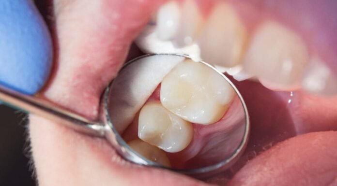 5 Simple Natural Home Remedies to Help Prevent Cavities and Support Healthy Teeth