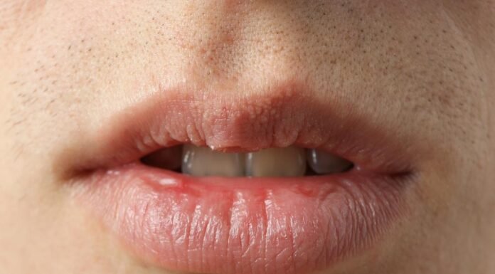 What causes unusual white spots or bumps to appear on the lips?