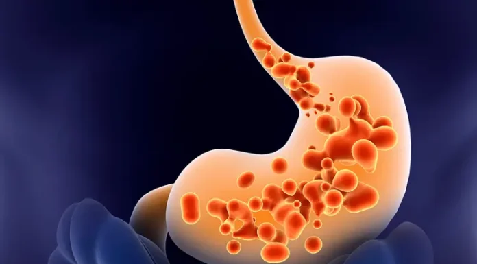 This drink helps reduce gastroesophageal reflux and heartburn effectively