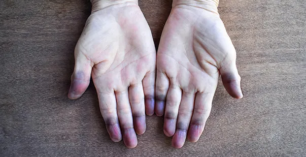 Warning Signs You Don’t Have Enough Oxygen in Your Blood