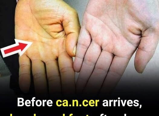 Before Cancer Is Diagnosed, Hands and Feet May Show These 4 Warning Changes