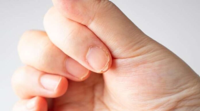 Doctor Reveals 7 Health Issues Hidden in Your Nails