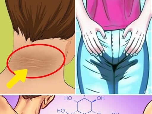 8 Signs That Indicate You Have Too Much Sugar