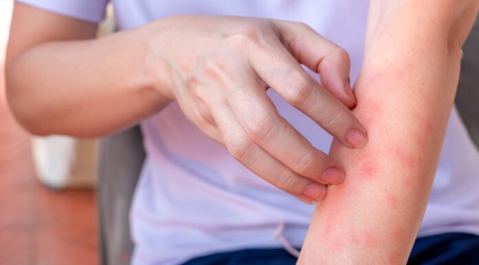 Two it.chy body parts may signal liver can.cer