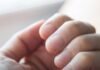 What Your Fingernails Might Reveal About Your Health