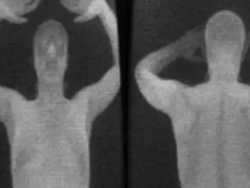 People Shocked To Learn What Airport Security Used To See Through Old X-Ray Scanners