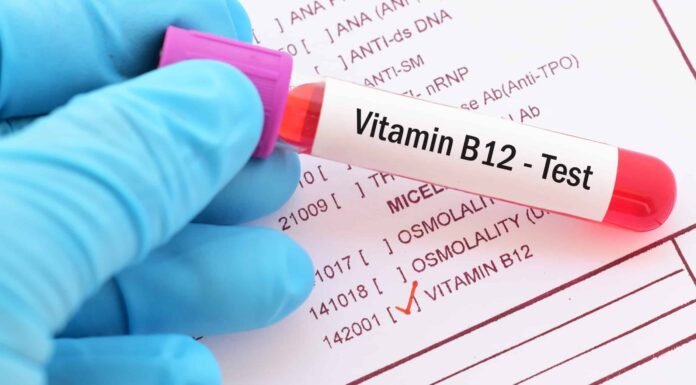 8 Strange (But Real) Signs Your Body Is Begging for More Vitamin B12 – Don’t Ignore These Red Flags