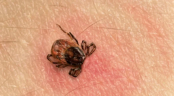 Why You Should Never Flush A Tick Down The Toilet