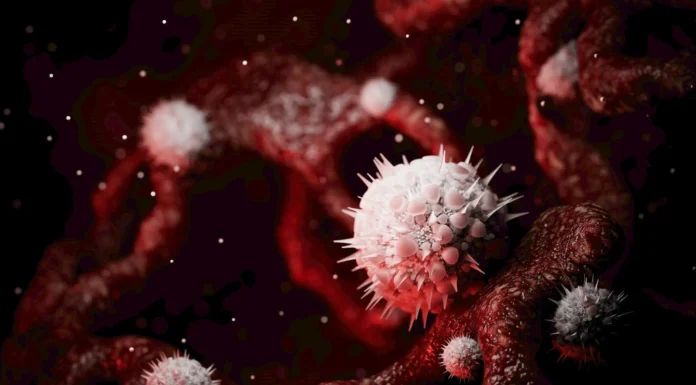 This Bedroom Behavior Overtakes Smoking as Primary Cause of Throat Cancer