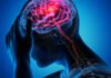 8 Warning Signs of Stroke That May Appear One Month Before and 9 Tips to Prevent It