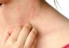 Itching in 9 Areas: A Warning Sign of Malignant Tumors, Number 7 Is the Most Common