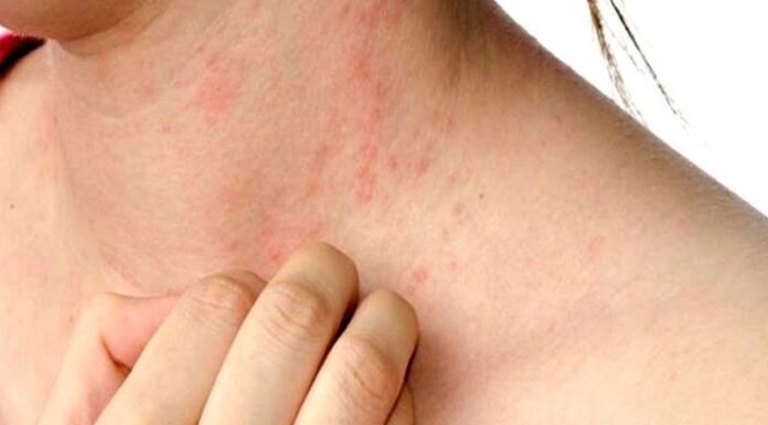 Itching in 9 Areas: A Warning Sign of Malignant Tumors, Number 7 Is the Most Common