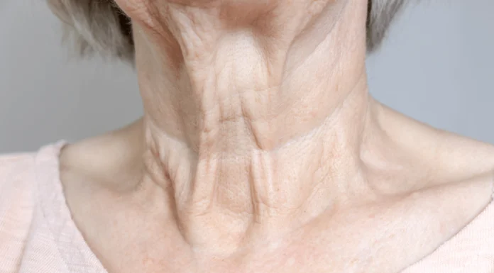 Why Neck Skin Sags with Age