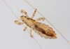 Doctors Will not Tell You this- Cheap Way to Get Rid of Lice Instantly