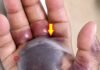 ATTENTION to These First Signs of Infection: Why Doctors Warn That Even a Small Cut or Insect Bite Needs Care