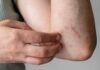 9 Types of Persistent Itching That Could Be Warning Signs of Underlying Health Problems
