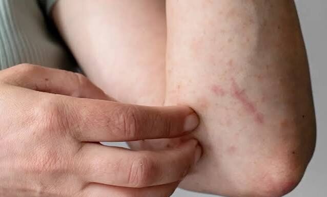 9 Types of Persistent Itching That Could Be Warning Signs of Underlying Health Problems