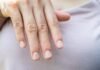 Doctor Uncovers A Telltale Sign In Your Fingernails That May Predict Your Life Expectancy