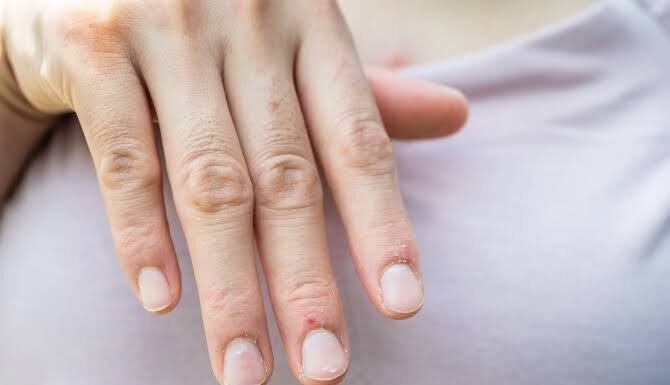 Doctor Uncovers A Telltale Sign In Your Fingernails That May Predict Your Life Expectancy