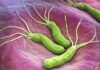 Millions Carry H. Pylori Without Knowing It — Could You Be One of Them?