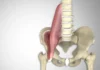 A Protruding Lower Belly and a Stiff Lower Back: What the Psoas Muscle May Have to Do With It