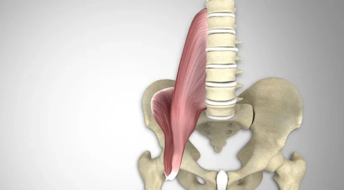 A Protruding Lower Belly and a Stiff Lower Back: What the Psoas Muscle May Have to Do With It